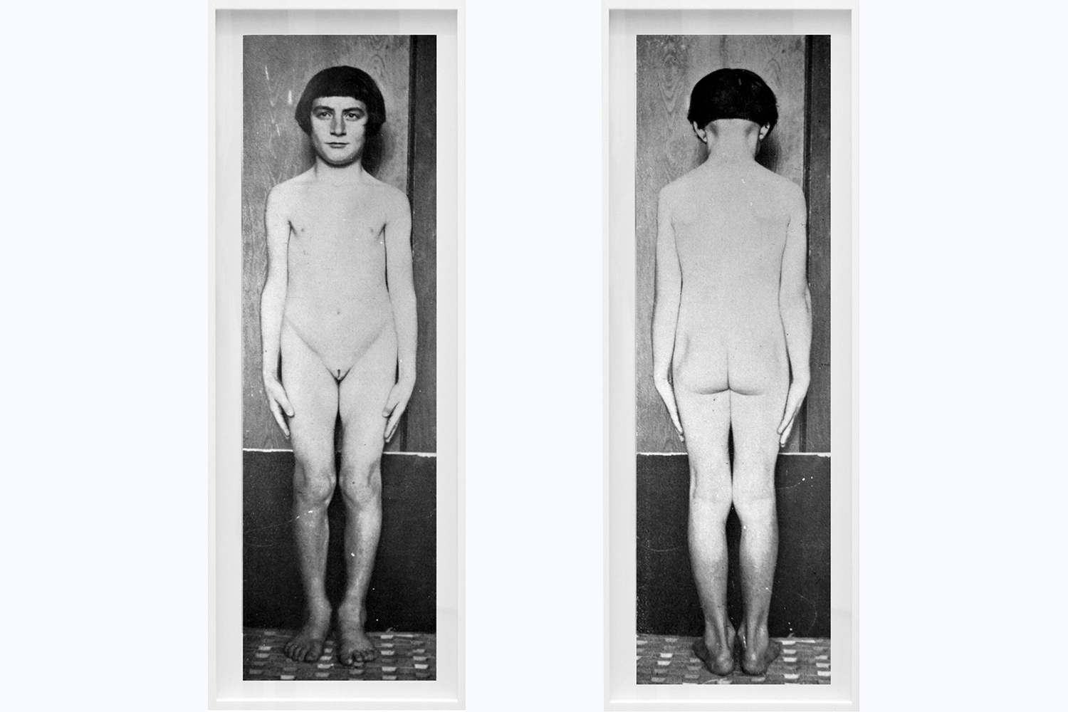 photos of the hermaphrodites, psychiatric institute