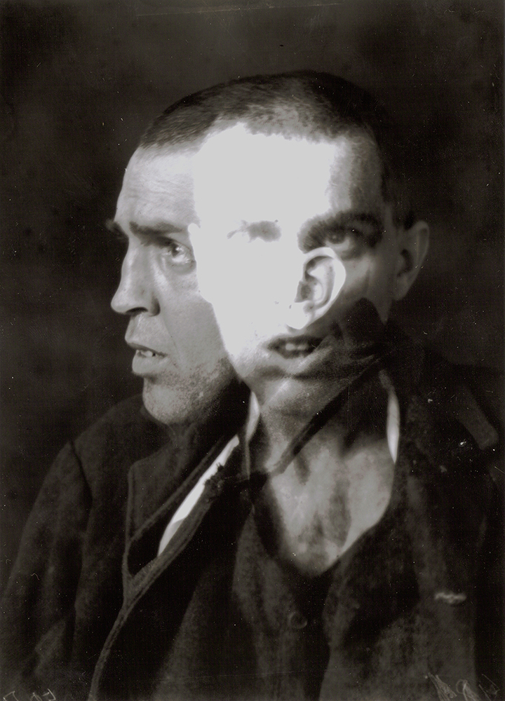 Photos of psychiatric hospital, patients, photo of madness